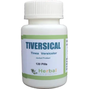 Tinea-Versicolor-Herbal-Treatment-500x500-1-1