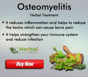 Osteomyelitis